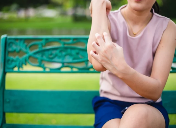 Woman on park bench in pink tank top and shorts scratching her forearm. 