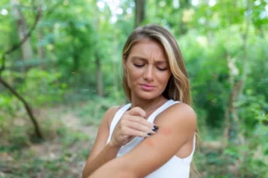 Young woman irritated by mosquito bites on her arm.