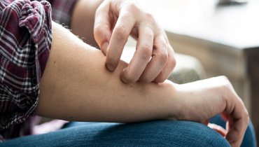 Person scratching their arm, wearing a plaid shirt and jeans.