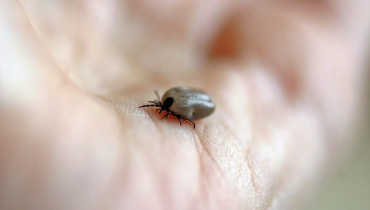 A close-up of a tick on human skin.