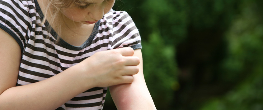 Young girl scratching red mosquito bite on her arm